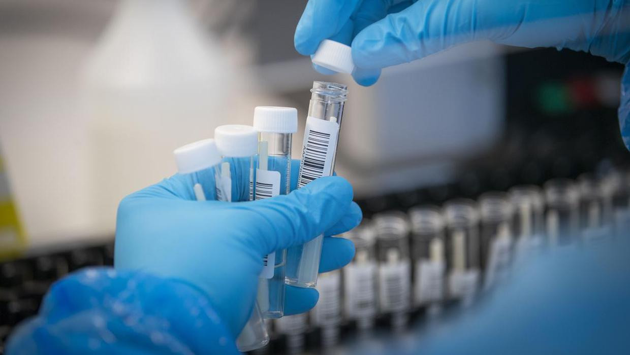 Azərbaycanda COVID-19 infeksiyasına 108 yoluxma faktı qeydə alınıb